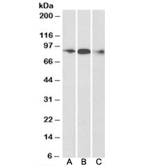 Western blot testing of human frontal cortex [A], mouse [B] and rat [C] brain lysate with ELMO1 antibody at 0.3ug/ml. Predicted molecular weight: ~84kDa.~