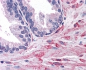 IHC staining of FFPE human prostate with ELMO2 antibody at 4ug/ml. HIER: steamed with pH6 citrate buffer, AP-staining. Pixulated staining in the cytoplasm of stroma cells is seen.