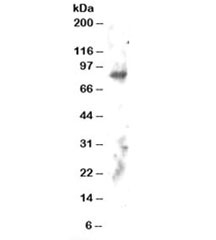 Western blot testing of human brain lysate with ELMO2 antibody at 2ug/ml. Predicted molecular weight: ~82kDa.~