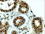 IHC staining of FFPE human breast with APE1 antibody at 4ug/ml. HIER: steamed with pH9 Tris/EDTA buffer, HRP-staining.