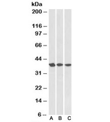 Western blot testing of A431 [A], HeLa [B] and MCF7 [C] nuclear lysates with APE1 antibody at 0.3ug/ml. Expected/observed molecular weight: ~38kDa.~