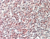 IHC staining of FFPE human spleen with CD2BP2 antibody at 5ug/ml. HIER: steamed with pH6 citrate buffer, AP-staining.