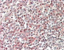 IHC staining of FFPE human spleen with CD2BP2 a