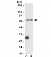 Western blot testing of mouse heart (A) and liver (B) lysate with CPT2 antibody at 1ug/ml. Predicted molecular weight: ~74kDa.