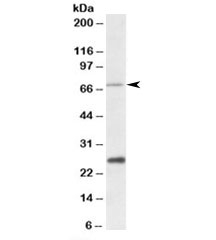 Western blot testing of human liver lysate with CPT2 antibody at 1ug/ml. Predicted molecular weight: ~74kDa. Both observed bands are blocked by the immunizing peptide.~
