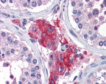 IHC testing of FFPE human testis tissue with Acylphosphatase 1 antibody at 3.75ug/ml. Required HIER: steamed