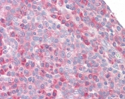 IHC testing of FFPE human tonsil tissue with MPS1 antibody at 3.75ug/ml. Required HIER: steamed antigen retrieval with pH6 citrate buffer; AP-staining.