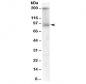 Western blot testing of human colon lysate with CDCP1 antibody at 1ug/ml. Expected molecular weight: 93 kDa (unmodified), 130-140 kDa (glycosylated), ~70 kDa (cleaved). Both observed bands are blocked by addition of immunizing peptide.