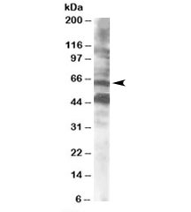 Western blot testing of human brain lysate with CPEB antibody at 0.5ug/ml. Both the expected ~65kDa band and the additional ~48kDa band are blocked by the immunizing peptide.
