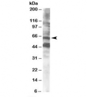 Western blot testing of human brain lysate  with CPEB antibody at 0.5ug/ml. Both the expected ~65kDa band and the additional ~48kDa band are blocked by the immunizing peptide.