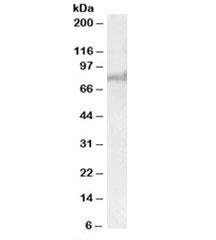Western blot testing of human liver lysate with ABCD2 antibody at 1ug/ml. Predicted molecular weight: ~83kDa.