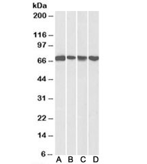 Western blot testing of mouse NIH3T3 [A], HeLa [B], A431 [C] and Jurkat [D] nuclear lysates with DDX5 antibody at 0.3ug/ml. Predicted molecular weight: ~68kDa.
