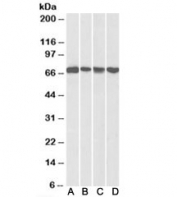 Western blot testing of mouse NIH3T3 [A] and human HeLa [B], A431 [C] and Jurkat [D] nuclear lysates with DDX5 antibody at 0.3ug/ml. Predicted molecular weight: ~68 kDa.
