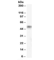 Western blot testing of human kidney lysate with KLK1 antibody at 0.5ug/ml. Predicted/observed molecular weight: ~29/45-50kDa.