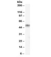 Western blot testing of human kidney lysate with KLK1 antibody at 0.5ug/ml. Predicted/observed molecular weight: ~29/45-50kDa.