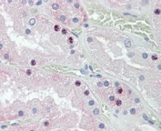 IHC staining of FFPE human kidney with HOXD10 antibody at 4ug/ml. HIER: steamed with pH6 citrate buffer, AP-staining.