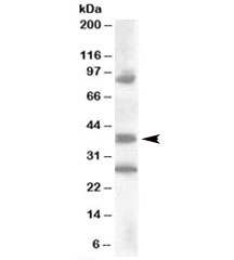 Western blot testing of human kidney lysate with HOXD10 antibody at 0.2ug/ml. Predicted molecular weight: ~38kDa. The observed bands are blocked by addition of the immunizing peptide.~