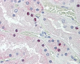 IHC staining of FFPE human kidney with HOXD10 anti