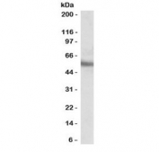 Western blot testing of human MOLT4 cell lysate with ERG antibody at 0.1ug/ml. Predicted molecular weight ~54 kDa.