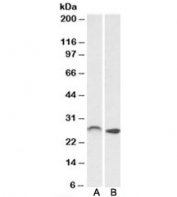 Western blot of mouse (A) and rat (B) brain lysates with HOXC6 antibody at 0.01ug/ml. Predicted molecular weight: ~27kDa.