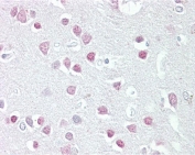 IHC testing of FFPE human brain (cortex) tissue with MC5R antibody at 2.5ug/ml. Required HIER: steamed antigen retrieval with pH6 citrate buffer; AP-staining.