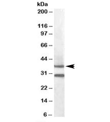 Western blot testing of mouse muscle lysate with MC5R antibody at 0.3ug/ml. Predicted molecular weight: ~37kDa. Both observed bands are blocked by addition of immunizing peptide.~