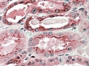 IHC staining of FFPE human kidney with GGCX antibody at 5ug/ml. HIER: steamed with pH6 citrate buffer, AP-staining.