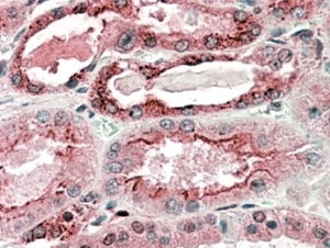 IHC staining of FFPE human kidney with GGCX antibody at 5ug/ml. HIER: steamed with pH6 citrate buffer, AP-staining.
