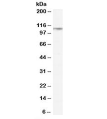Western blot testing of rat lung lysate with CD26 antibody at 0.3ug/ml. Predicted molecular weight: ~88/110kDa (unmodified/glycosylated).