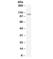 Western blot testing of rat lung lysate with CD26 antibody at 0.3ug/ml. Predicted molecular weight: ~88 kDa (unmodified), ~110 kDa (glycosylated).