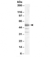 Western blot testing of Jurkat lysate with SMARCE1 antibody at 0.2ug/ml. Predicted molecular weight: ~47kDa.
