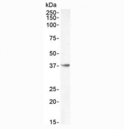Western blot testing of mouse skeletal muscle lysate with HOXA10 antibody at 0.3ug/ml. Predicted molecular weight: ~42 kDa.