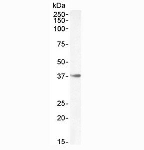 Western blot testing of mouse skeletal muscle lysate with HOXA10 antibody at 0.3ug/ml. Predicted molecular weight: ~42 kDa.