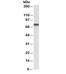 Western blot testing of A431 lysate with Progranulin antibody at 1ug/ml. Predicted molecular weight: 64/70~88kDa (unmodified/glycosylated), observed here at ~75kDa.