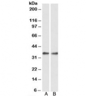 Western blot of rat spleen (A) and lung (B) lysate with PPP4C antibody at 0.3ug/ml. Predicted molecular weight: ~35kDa.