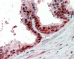 IHC staining of FFPE human prostate with PPP4C antibody at 2.5ug/ml. HIER: steamed with pH6 citrate buffer, AP-staining.