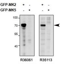 Western blot of HEK293 lysate overexpressing mouse MK2/MAPKAPK2-GFP or overexpressing MK5-GFP and probed with MAPKAPK2 antibody (0.5ug/ml, <a href=../tds/mapkapk2-antibody-r36061>catalog # R36061</a>) in the left panel and with MAPKAPK2 antibody (0.5ug/ml, cat # R35113) in the right panel.~