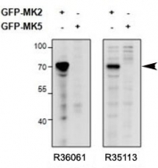 Western blot of HEK293 lysate overexpressing mouse MK2/MAPKAPK2-GFP or overexpressing MK5-GFP and probed with MAPKAPK2 antibody (0.5ug/ml, catalog # R36061) in the left panel and with MAPKAPK2 antibody (0.5ug/ml, cat # R35113) in the right panel. Predicted molecular weight of MAPKAPK2+GFP: ~72kDa.
