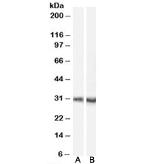 Western blot testing of mouse brain lysate with A) Dcdc2a antibody, cat # R35120 (0.1ug/ml) and B) <a href=../tds/dcdc2-antibody-r33450>DCDC2 antibody, cat # R33450</a> (0.1ug/ml). Predicted molecular weight (mouse): ~52/41kDa (isoforms 1/2), observed here at ~30kDa.