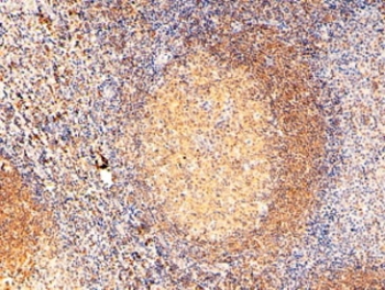 IHC staining of FFPE human tonsil tissue with RAC2 antibody at 2ug/ml. Required HIER: steamed antigen retrieval with pH9 EDTA buffer.~