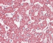 IHC staining of FFPE human liver with ETFB antibody at 4ug/ml. HIER: steamed with pH6 citrate buffer, AP-staining.