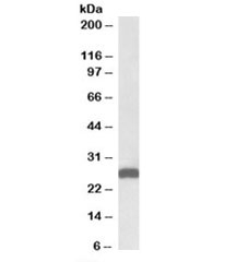 Western blot testing of mouse liver lysate with ETFB antibody at 0.01ug/ml. Predicted molecular weight: ~28kDa.~