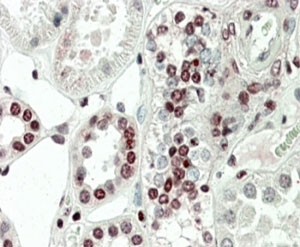 IHC staining of FFPE human kidney with PRAK antibody at 5ug/ml. HIER: steamed with pH6 citrate buffer, AP-staining.