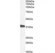 IHC testing of FFPE human heart tissue with NKX2.5 antibody at 3.75ug/ml. Required HIER: steamed antigen retrieval with pH6 citrate buffer; AP-staining.