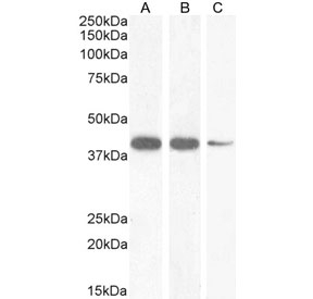 Western blot testing of A) human heart, B) mouse heart and C) rat heart tissue lysate with NKX2.5 antibody at 1ug/ml. Predicted molecular weight ~35 kDa, routinely observed at 35~45 kDa.~