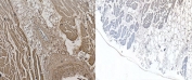 IHC testing of FFPE human heart tissue with NKX2.5 antibody (left) and without NKX2.5 antibody (right). Required HIER: steamed antigen retrieval with pH6 citrate buffer; AP-staining.
