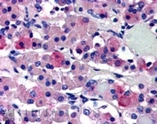 IHC staining of FFPE human anterior pituitary gland with AVPR1B antibody at 5ug/ml. HIER: steamed with pH6 citrate buffer, AP-staining.