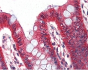 IHC testing of FFPE human colon tissue with Perilipin antibody at 2ug/ml. Required HIER: steamed antigen retrieval with pH6 citrate buffer; AP-staining.