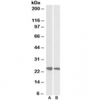 Western blot of human (A) and pig (B) spleen lysates with GRB2 antibody at 0.03ug/ml.Predicted molecular weight ~25kDa.