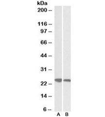Western blot of human (A) and pig (B) spleen lysates with GRB2 antibody at 0.03ug/ml.